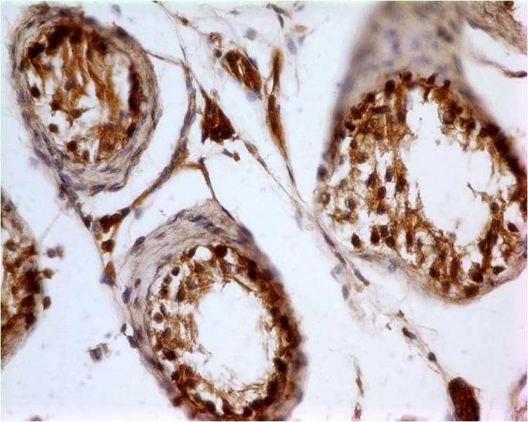 INHA / Inhibin Alpha Antibody