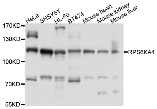 Polyclonal Rabbit anti-Human RPS6KA4 / MSK2 / RSK-B Antibody (WB)