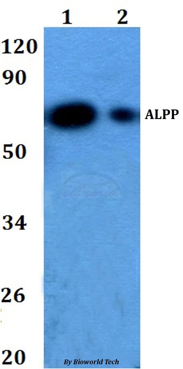 Polyclonal Rabbit anti-Human PLAP / Alkaline Phosphatase Antibody (WB)