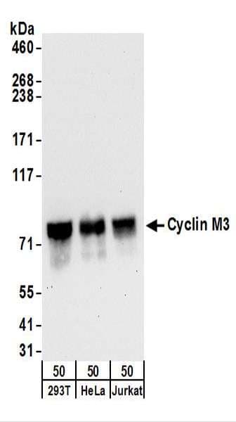 Polyclonal Rabbit anti-Human CNNM3 Antibody (aa657-707, WB)