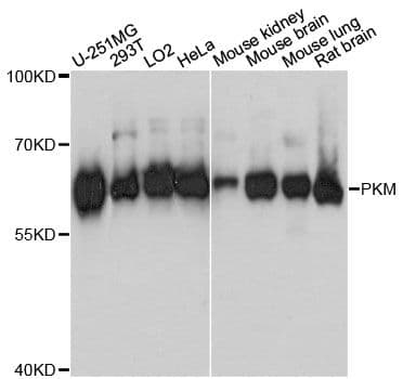 Polyclonal Rabbit anti-Human PKM / Pyruvate Kinase, Muscle Antibody (WB)