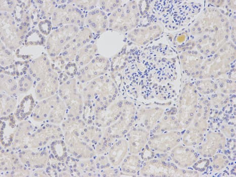 Polyclonal Rabbit anti-Human DDB2 Antibody (IHC, IF, WB)