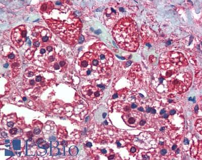 IHC-plus™ PEBP1 / RKIP Antibody