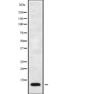 CCL17 / TARC Antibody