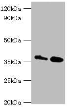 Polyclonal Rabbit anti-Human CTSK / Cathepsin K Antibody (aa115-329, IHC, WB)