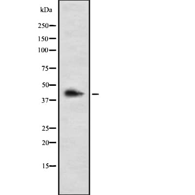 Polyclonal Rabbit anti-Human LHX3 Antibody (WB)