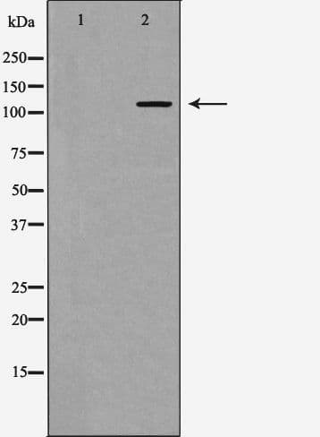 PIK3CA / PI3K Alpha Antibody