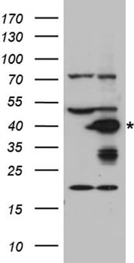 AGXT / SPT Antibody