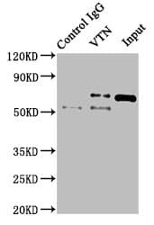 VTN / Vitronectin Antibody (aa364-478)