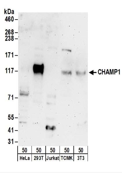 C13orf8 / ZNF828 Antibody (aa762-812)