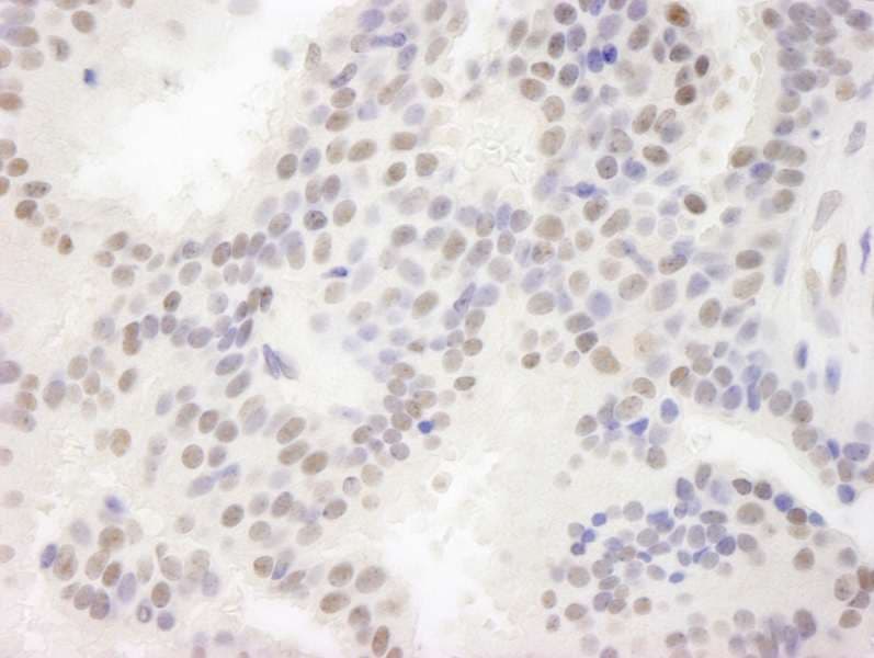 Polyclonal Rabbit anti-Human MAML3 / CAGH3 Antibody (aa1100-C-term, IHC)