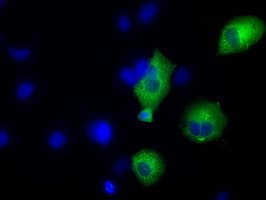 ERIC-1 / TACC3 Antibody (clone OTI6F1, Carrier-free)
