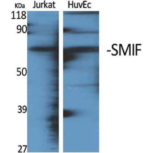 Polyclonal Rabbit anti-Human SMIF / DCP1A Antibody (80-160 aa, Internal, IHC, WB)