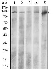 Monoclonal Mouse anti-Human ACLY / ATP Citrate Lyase Antibody (clone 5F8D11, IHC, IF, WB)
