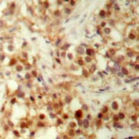 Polyclonal Rabbit anti-Human TP53 / p53 Antibody (N-Terminus, IHC, WB)