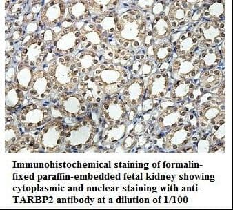 TARBP2 / TRBP2 Antibody (aa38-281)