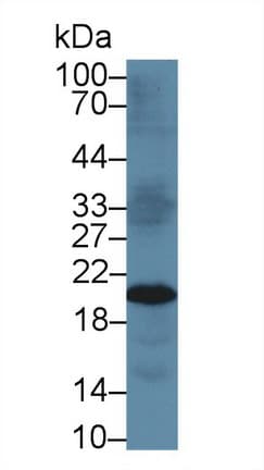 TIMP3 Antibody (aa26-211)