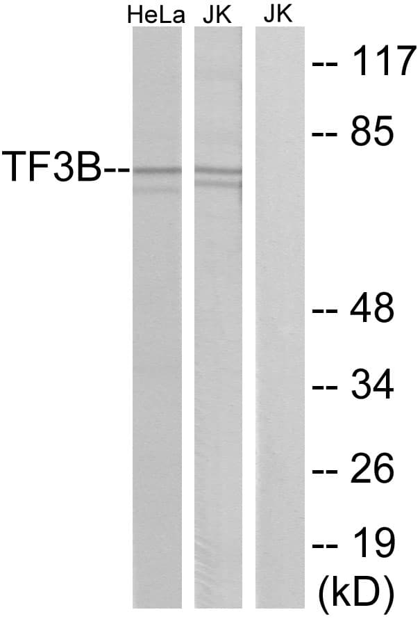 Polyclonal Rabbit anti-Human BRF1 Antibody (aa231-280, IHC, IF, WB)