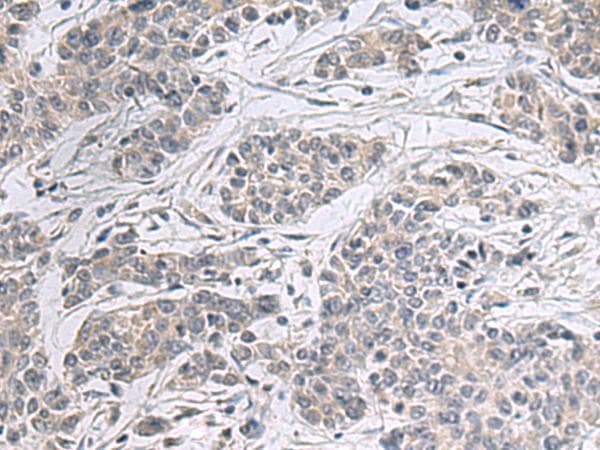 PPM1K Antibody