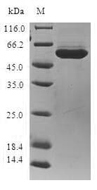 Human AKR1B10 Protein (Recombinant GST, N-terminus)