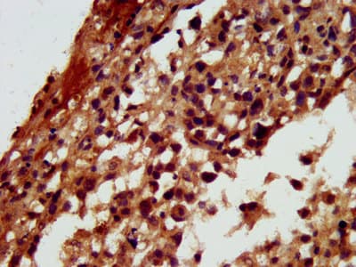 RGS6 Antibody