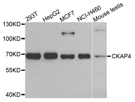Polyclonal Rabbit anti-Human CKAP4 Antibody (AP, IHC, WB)