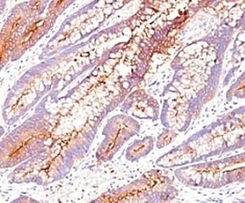 CEA / Carcinoembryonic Antigen Antibody (clone SPM584)