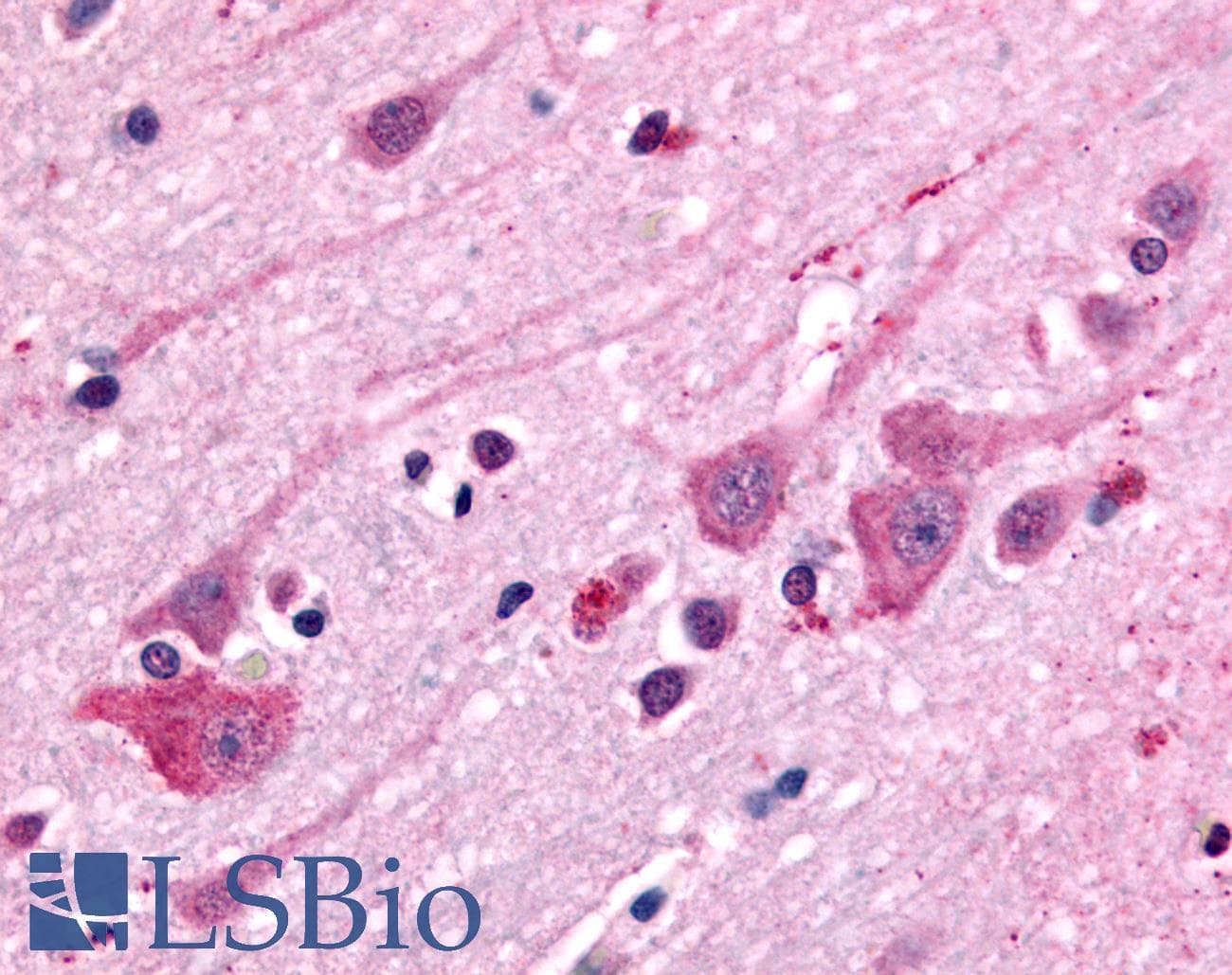 PathPlus™ DRD1 / Dopamine Receptor D1 Antibody (Extracellular Domain)