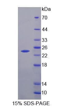 Human HPCAL4 Protein (Recombinant His, N-Terminal)
