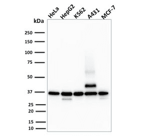 RAD51 / RECA Antibody (clone RAD51/2701)