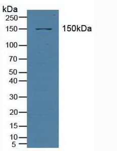 ABCC3 / MRP3 Antibody (aa1291-1523, Biotin)