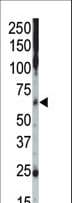 CSNK1G2 / CKI-Gamma 2 Antibody (aa329-360)