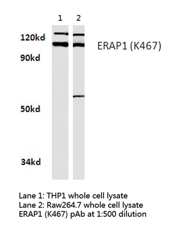 Polyclonal Rabbit anti-Human ARTS1 / ERAP1 Antibody (Lys467, IHC, IF, WB)
