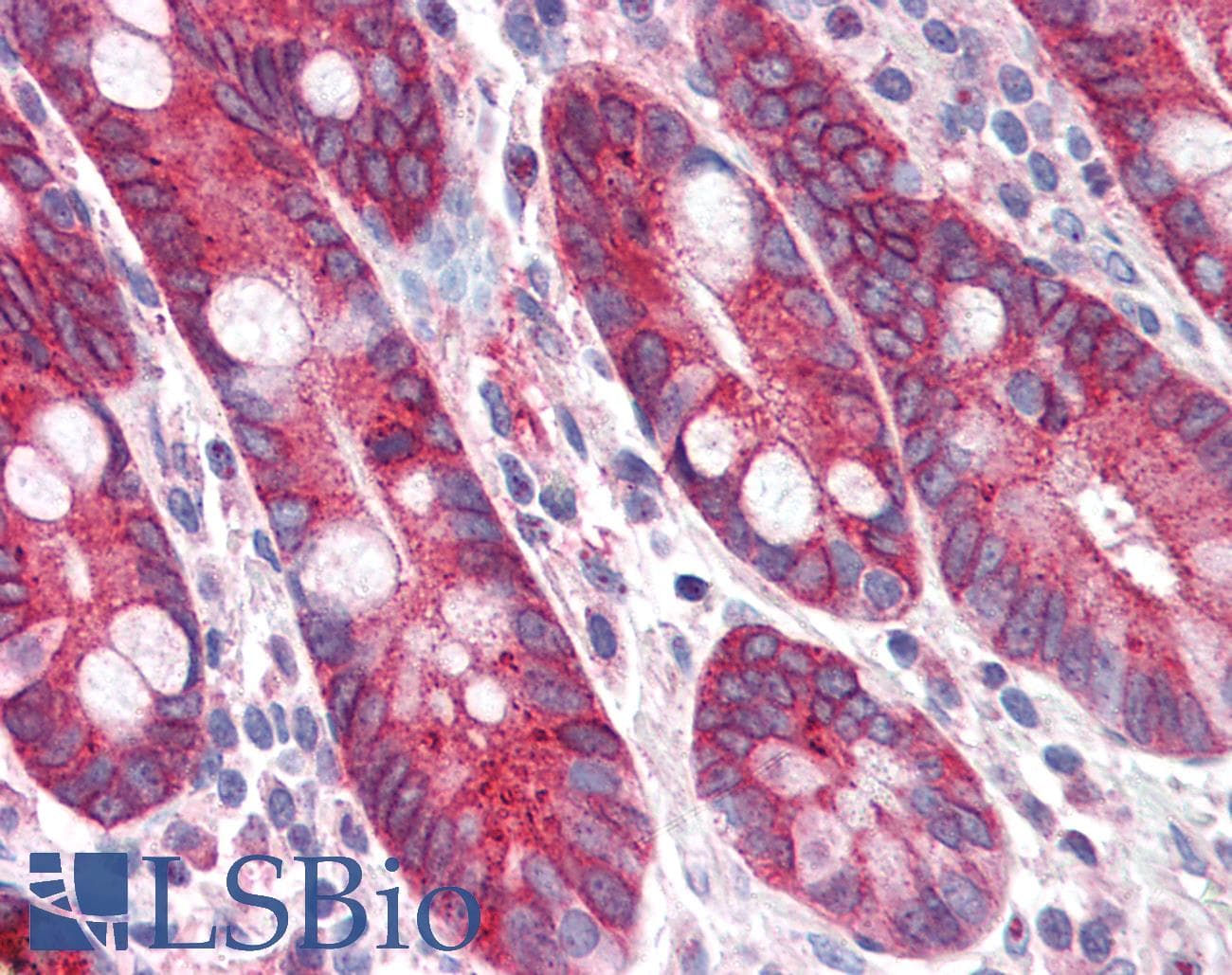 IHC-plus™ PIGR Antibody (Internal)
