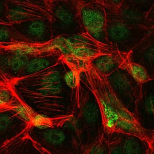 JUN / c-Jun Antibody (clone 5B1)