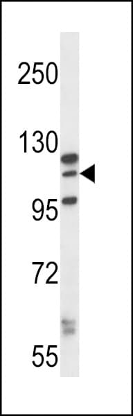 MORC1 Antibody (aa892-921)