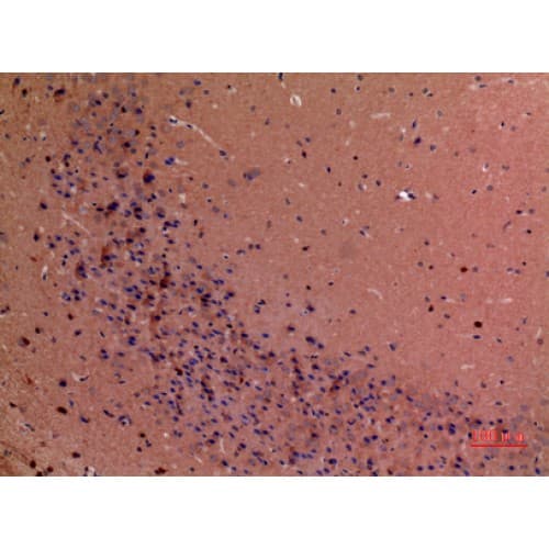 GDI2 Antibody (C-terminal)