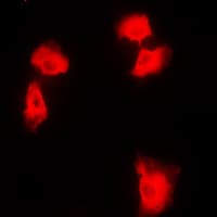 NFKB2 Antibody (C-Terminus)