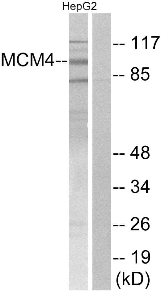 MCM4 Antibody (p54)