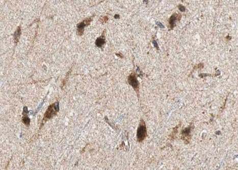 GAD1 / GAD67 Antibody