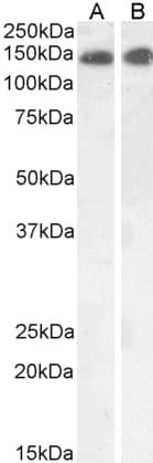 IHC-plus™ LEPR / Leptin Receptor Antibody (aa829-841)