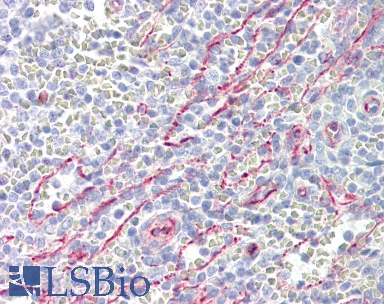 IHC-plus™ SLC25A21 / ODC1 Antibody (aa134-183)
