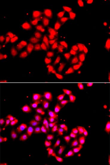 Polyclonal Rabbit anti-Human CAMK1D Antibody (IHC, IF, WB)