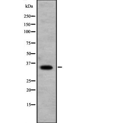 RFPL1 Antibody