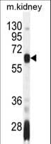 Polyclonal Rabbit anti-Human AIRE Antibody (aa64-92, IF, WB)