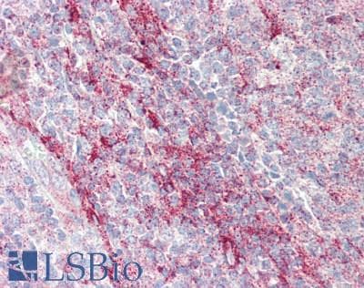 IHC-plus™ IL1F9 Antibody (clone 2A8)