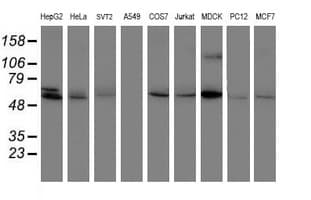 PPAT Antibody (aa42-278, clone OTI1B8)