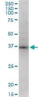 IHC-plus™ STX18 / Syntaxin 18 Antibody (clone 2E5)
