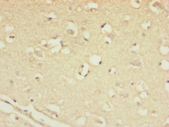 Polyclonal Rabbit anti-Human CSPP1 Antibody (IHC, WB)