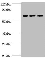 PIAS2 / PIASX Antibody (aa532-621)